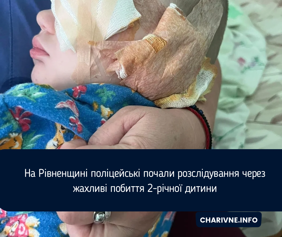 Фото ілюстративне